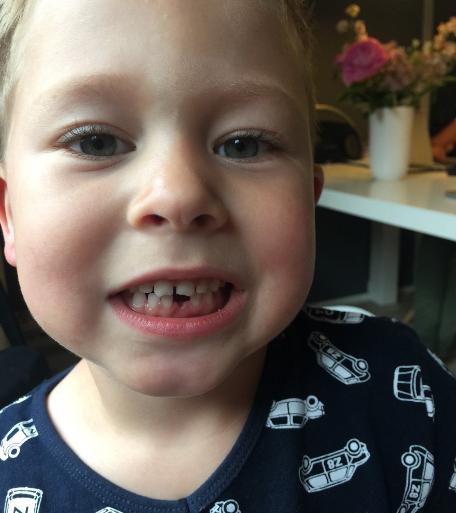 Tand wisselen