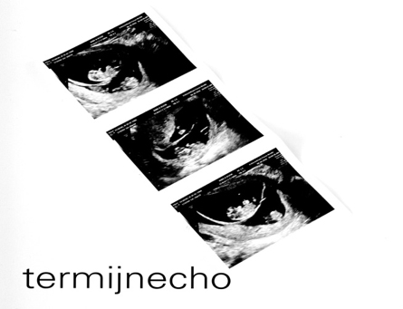termijnecho tweeling