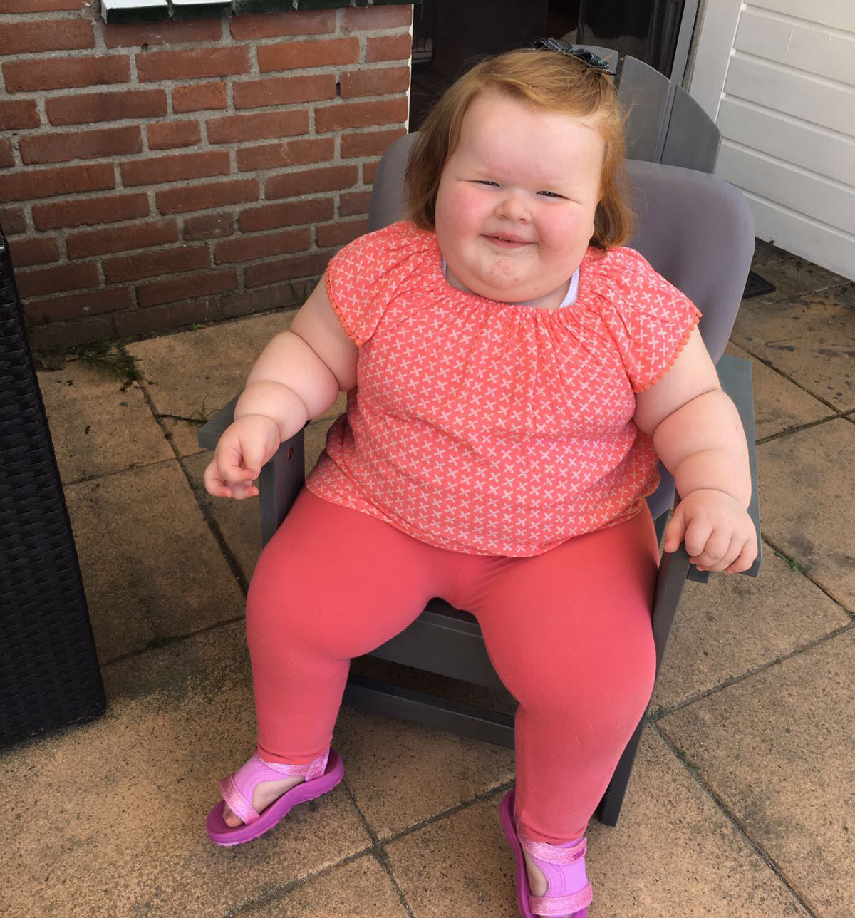 genetisch Onvoorziene omstandigheden Ordelijk Sara heeft aangeboren Obesitas | Twinkelbella
